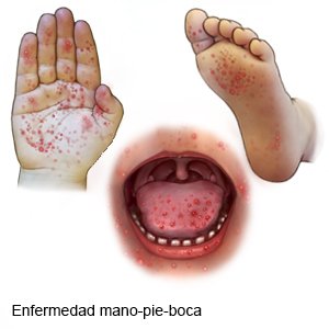 Protocolo Mano Boca y Pies