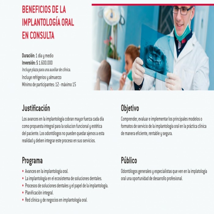 Beneficios de la implantologia oral en consulta