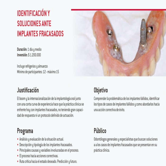 Identificación y soluciones ante implantes fracasos
