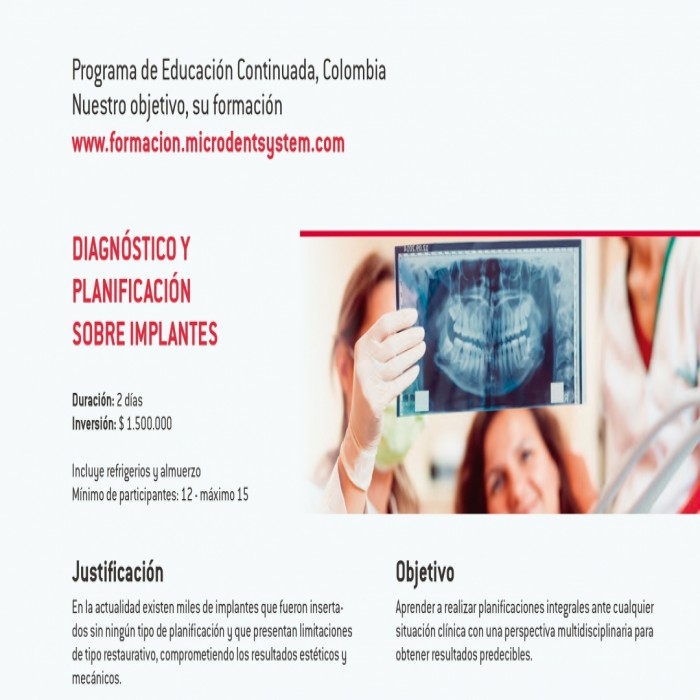 Diagnostico y planificación sobre implates