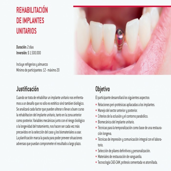 Rehabilitación sobre implantes unitarios