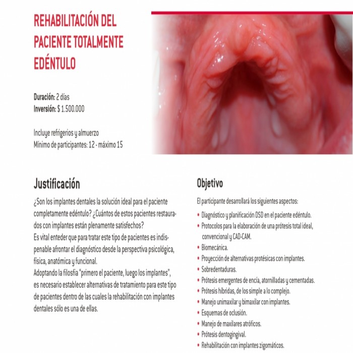 Rehabilitación del paciente totalmente edentulo