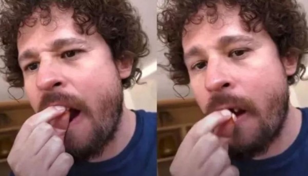 Luisito Comunica pierde dos dientes en transmisión en vivo, generando preocupación entre sus seguidores