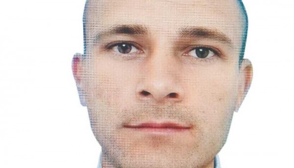 La bala le quedó en el ojo