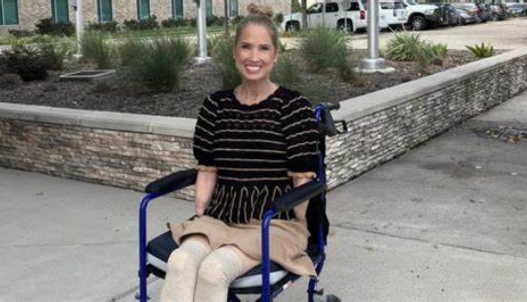 Maestra acude a hospital por síntomas de gripa y le amputan sus extremidades