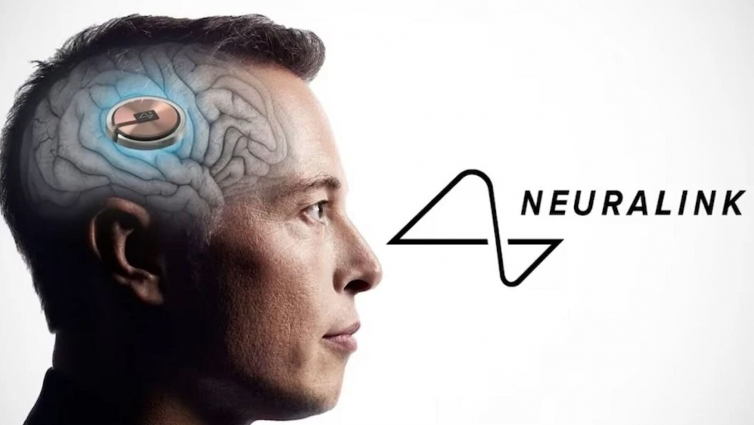 Primer humano en recibir el chip cerebral Neuralink puede mover el cursor y juega ajedrez usando su cerebro