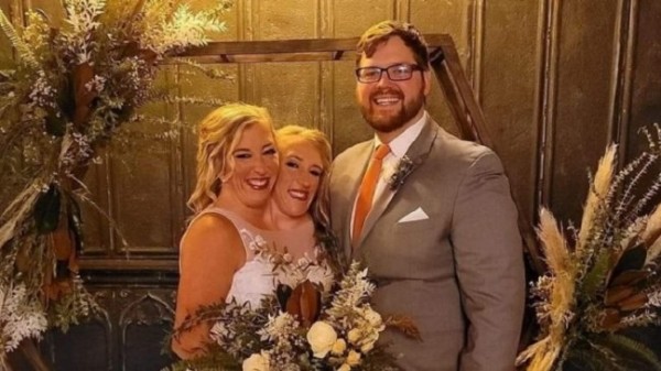 [Video] Abby Hensel una de las gemelas siameses se casó con un veterano del ejército