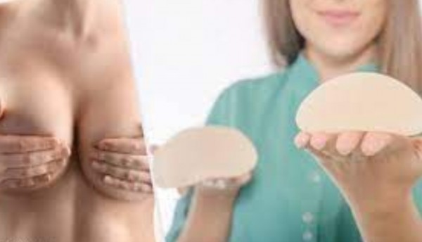 Esto es lo que debe de saber antes de realizarse una mamoplastia