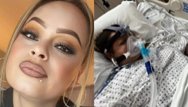 Mujer mexicana pierde extremidades después de consumir tilapia poco cocida